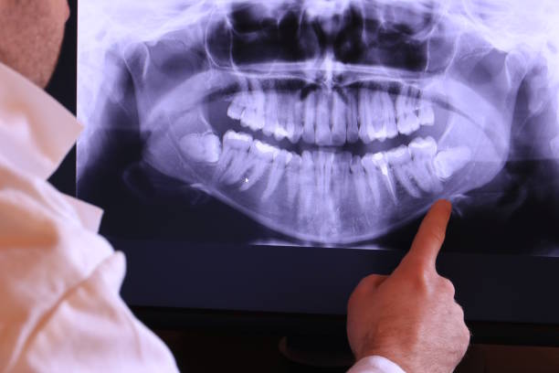 Best Tooth Pain Emergency Relief  in Parkston, SD
