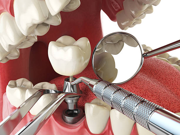 Best Tooth Infection Emergency Dentist  in Parkston, SD